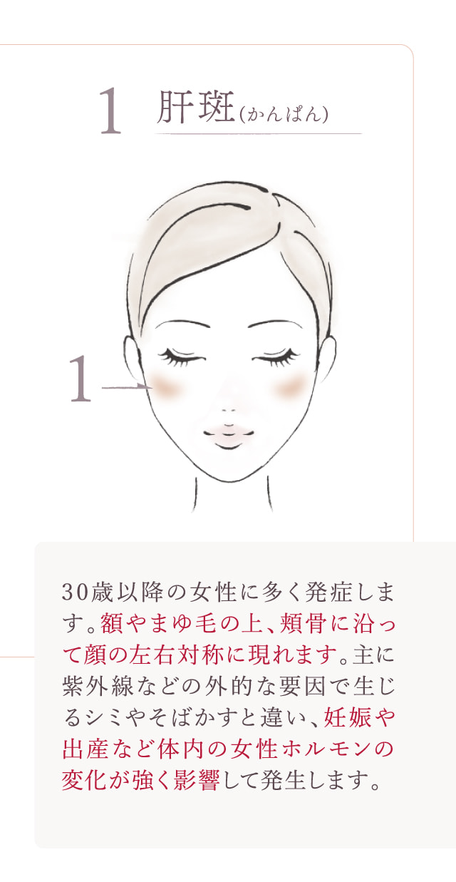 lemo☆取引前にプロフ確認お願いします さん専用TAクリームAAｎ4セット EIKO エーコー 宿泊施設用セキュリティボックス ReZERO LOCK