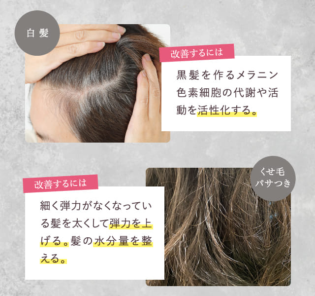 メディケイテッド ヘアグロースエッセンス 4本セット メディケイテッド ヘアグロースエッセンス 4本セット メディケイ