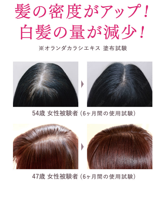 メディケイテッド ヘアグロースエッセンス 4本セット IT'S WHAT'S INSIDE THAT MATTERS. / スカルプ